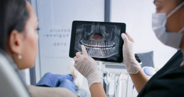 Licensed Tooth Extraction service in Saratoga, CA - Smile Center Dentistry